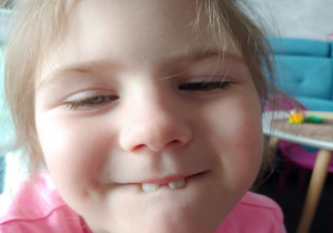 dziewczynka przygryza wargę górnymi (dwoma) zębami
